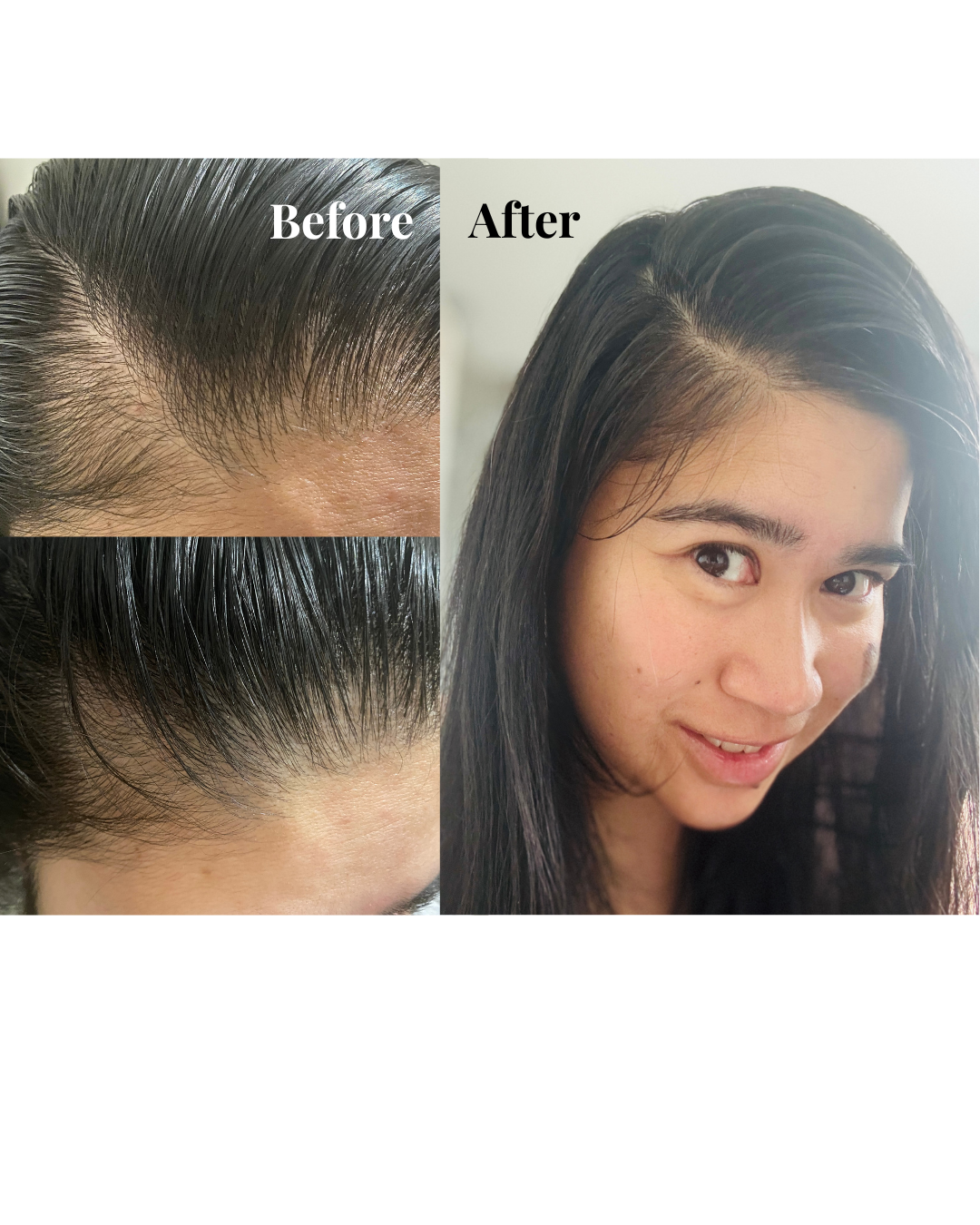 Low Energy Hair Care Routine with Hair Oil & Scalp Roller